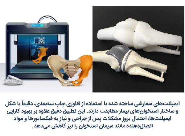 چاپ سه بعدی پروتز