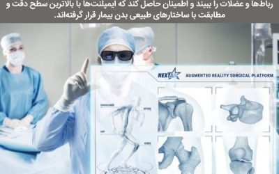 جدیدترین روش‌های جراحی تعویض مفصل زانو در دنیا